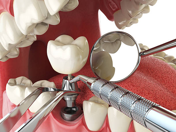 Best Emergency Treatment for Jaw Pain or Injury in Kuna, ID